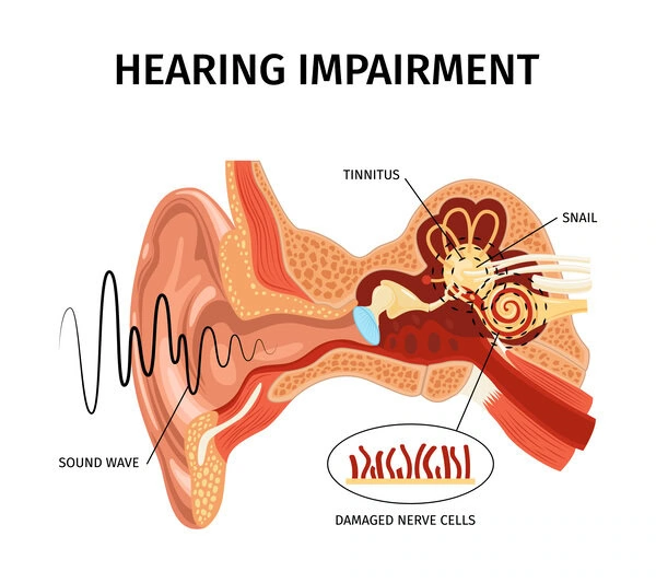Hearing Loss Symptoms Best Hearing Aid Centre Kl Selangor 3